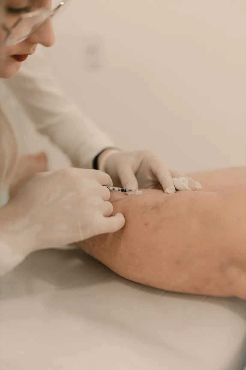 Tratamiento vascular